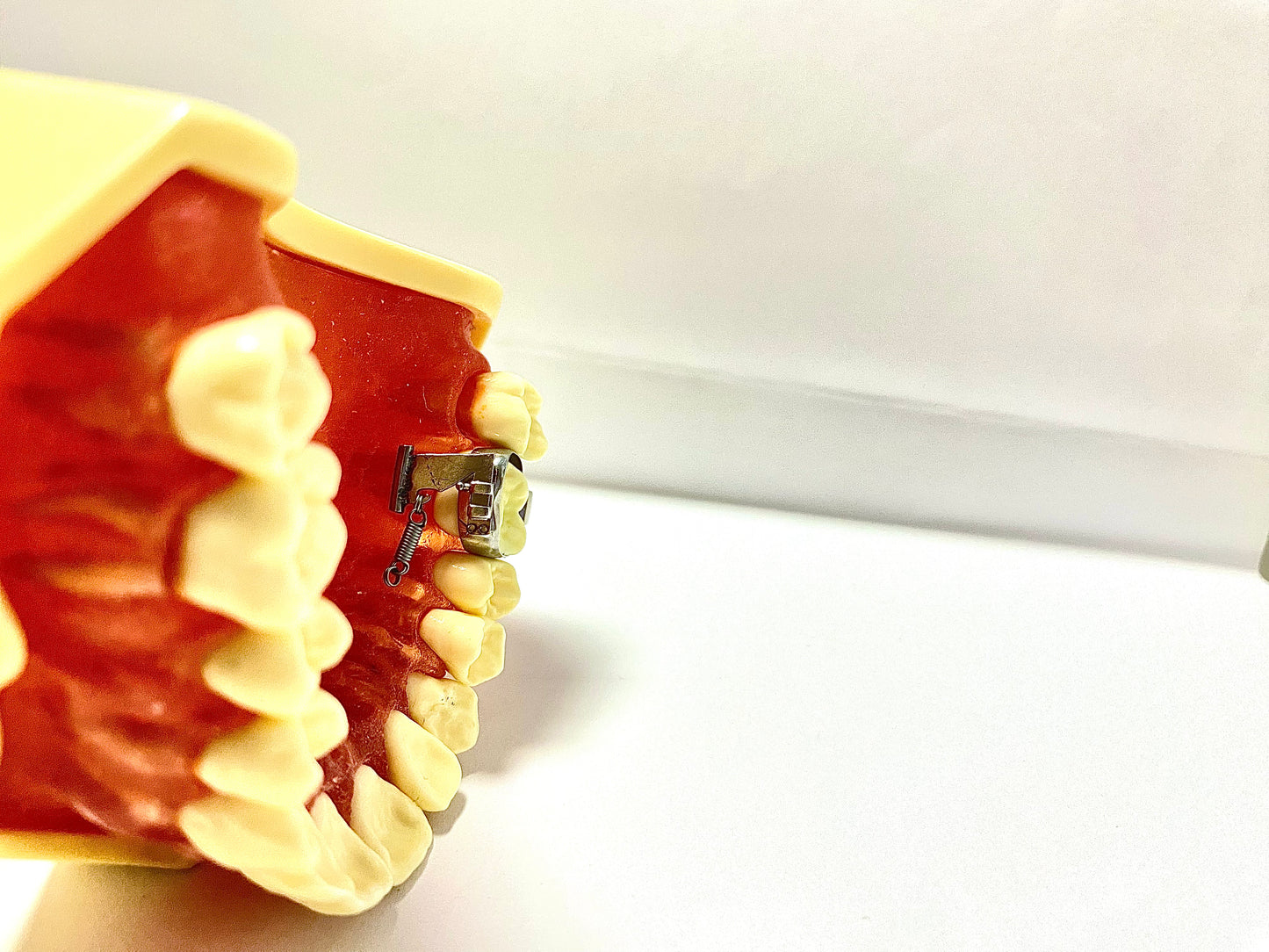 Palatal Power Arm Sliding
