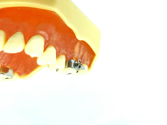 Üst Double Tüplü Molar Bantlar