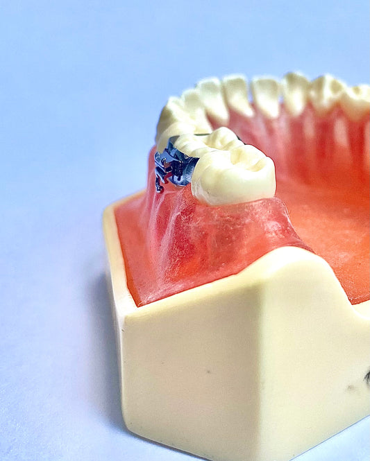 Alt Single tüplü molar bant