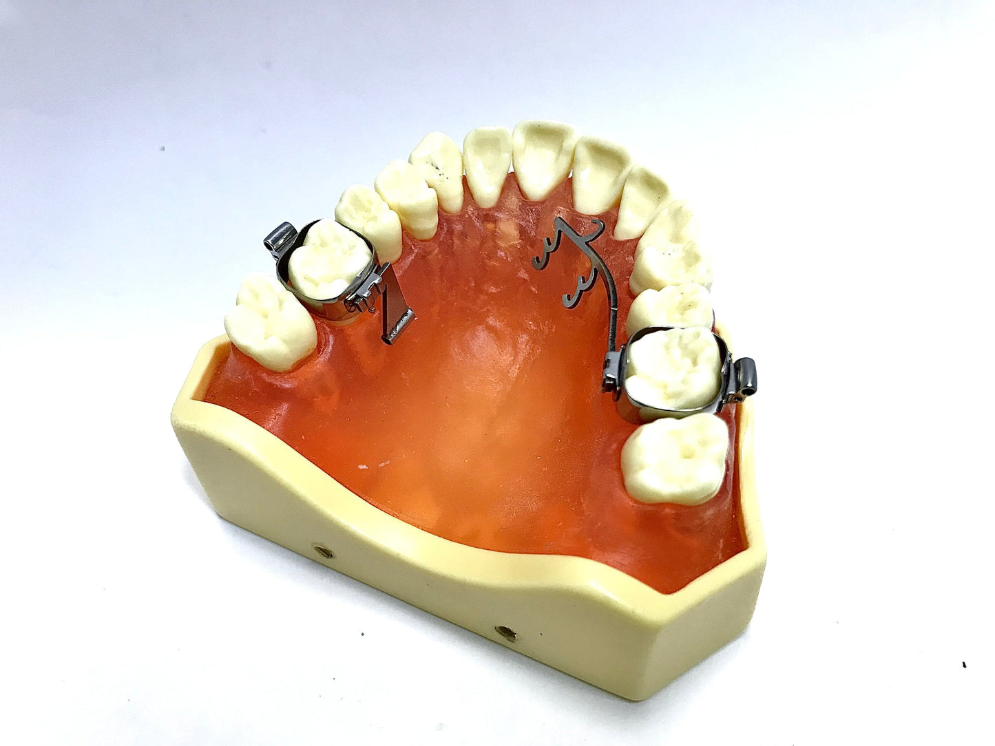 Palatal Power Arm Sliding