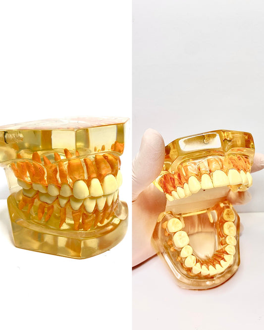 Crystal Teeth Model Full Dentition