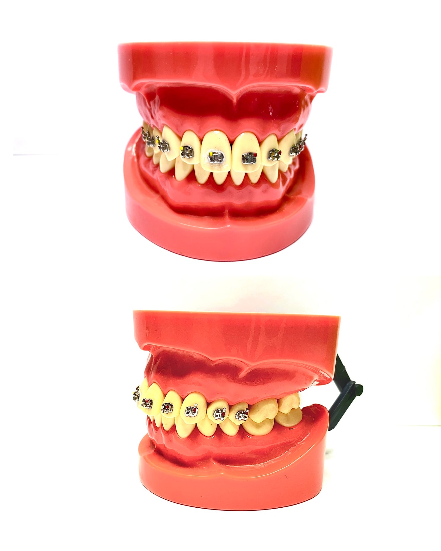 Üst Braketli Model